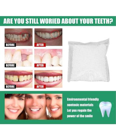 Teeth Adhesive Fitting Beads - Temporary Dental Filling for Broken or Missing Teeth - 50g (White) - Buy Online on GoSupps.com