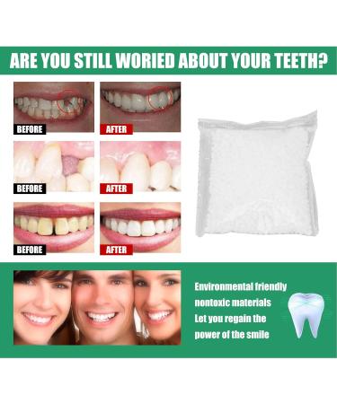 Tooth Repair Beads | Temporary Tooth Filling Kit for Broken & Missing Teeth - 50 White Beads - Buy Online on GoSupps.com