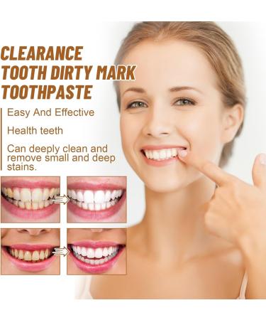 KLYso Powerful Stain Removing Toothpaste - Deep Clean Fresh Breath & Teeth Whitening Daily Oral Care for Sparkling Teeth(3PCS) - Buy Online on GoSupps.com