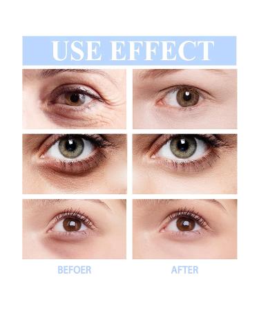 Retinol Firming Eye Serum Hydrating Eye Cream for Instantly Minimizes Puffiness Anti-Aging Treatment with Retinol & Peptides Fast-Absorbing for Women & Men - Buy Online on GoSupps.com