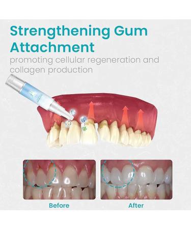 Buy Gum Protect Repair Gel | Ultimate Gum Protection & Repair Shield Gel for Healthy Gums - Fast International Shipping - Buy Online on GoSupps.com