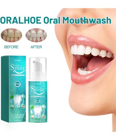 Furzero Smartsmile Mouthwash | Fresh Breath & Oral Care Solution | International Shipping - Buy Online on GoSupps.com