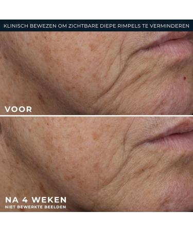 RoC Deep Wrinkle Rich Cream 50ml - Buy Online on GoSupps.com