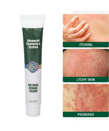 2PCS Herbal Itching Relief Ointment for Eczema Rash Repair - Moisturizing Cream for Dry, Irritated Skin - Buy Online on GoSupps.com