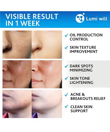 Glycolic Acid Pads 35% with Vitamin B5, C, E - Anti-Aging Facial Peel for Dark Spots, Acne & Wrinkles - Buy Online on GoSupps.com