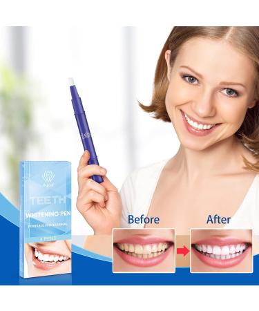 AGOAL Teeth Whitening Pen 4Pcs 20+ Uses, Effective, Painless, No Sensitivity, Travel-Friendly for Beautiful White Smile - Buy Online on GoSupps.com