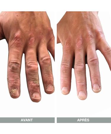 Cr me Mains Myrte Citronn Australian Bodycare Hand Cream (100 ml) | Baume 100% V gan pour Ecz ma & Dermatite | Hydratant Main S ches Ger ures & Craquelures | Huile d'Arbre Th et Myrte Citronn  - Buy Online on GoSupps.com