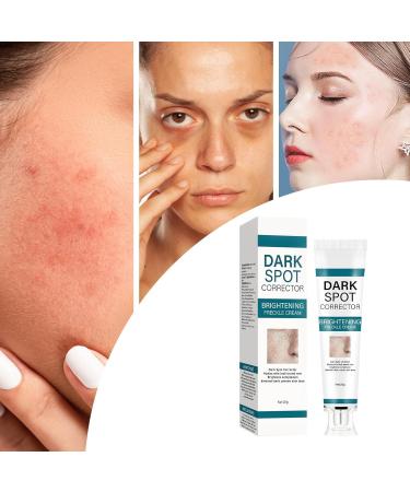 Dark S Corrector Cream Whiten S Moisturizer Skin Brightening Cream Facial Brightening Moisturizer Deep Skin Brightening Skin Tone Corrector Dark Remover Age S Cream - Buy Online on GoSupps.com