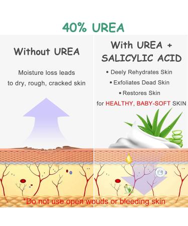 MOKYDUO 40% Urea Cream for Feet | Dry Skin, Cracked Heels, Calloused Feet | Foot Softening Lotion with Glycerin & Jojoba | 4.3 oz - Buy Online on GoSupps.com