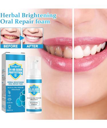 Jorondy Teeth Mouthwash & Furzero Herbal Brightening Oral Repair Foam - Tooth Whitening Mousse for Adults (3 Pieces) | International Shipping - Buy Online on GoSupps.com