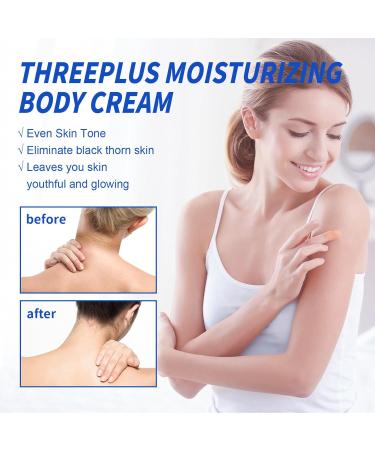 BEROZA Cremas Para Las Manchas de La Corporales 50G Para Piel Entrepierna Manchas Codos Piernas Zonas ntimas Cara Axilas Rodillas Cuello 50G - Buy Online on GoSupps.com