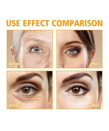 Retinol Caffeine Anti-Wrinkle Stay-Up Late Eye Cream Retinol & Caffeine Eye Serum Anti-Aging Eye Cream For Dark Circles & Puffiness (3PC) - Buy Online on GoSupps.com