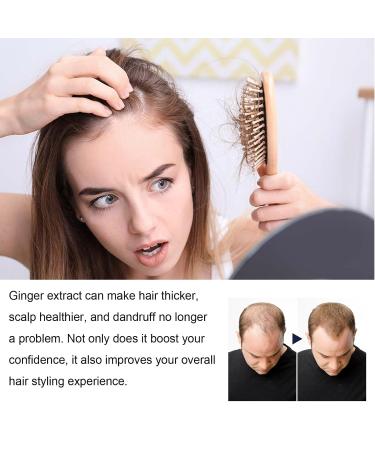 Hair Growth Serum & Lotion for Men & Women - Nourishing Hair Regrowth Treatment & Care - Buy Online on GoSupps.com