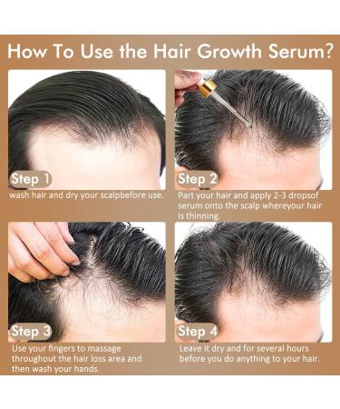 5% Minoxidil & Biotin Hair Growth Serum - 60ML for Men and Women | Hair Regrowth Treatment for Thicker, Longer, Healthier Hair | Prevent Scalp Hair Loss | Natural Formula for Fuller Hair - Buy Online on GoSupps.com