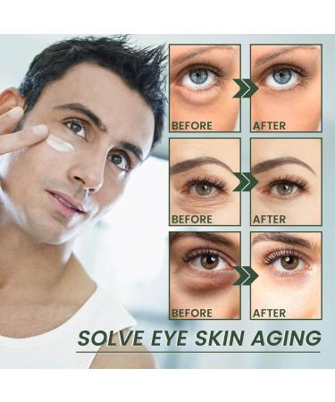 Anti-Aging Eye Cream for Puffiness Dark Circles & Fine Lines | Natural Moisturizer - Buy Online on GoSupps.com