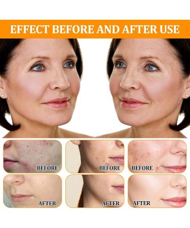 LINXINS Glycolic Acid 7% Toning - Buy Online on GoSupps.com