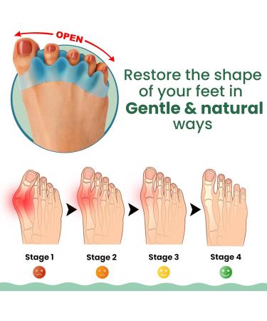 Buy XL Gel Toe Separators (6Pcs) - Bunion Relief & Hammer Toe Solution with Aloe Vera | Comfortable Toe Stretchers for Men & Women | Perfect for Yoga Practice - Buy Online on GoSupps.com