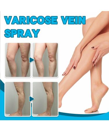 Cr me Apaisante pour les Jambes Creme Anti Varices Cr me pour Varices R paration des Jambes d'Araign e Varices Jambes Cr me Creme Anti Varices Cr me de Soin Hydratante Jambes 30G - Buy Online on GoSupps.com