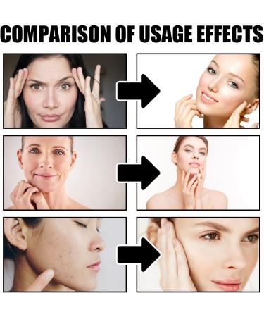 Shantou Yingji Dragons Blood Easy Cream Firming facial cream + antiwrinkle facial serum 50 g and dragons blood 30 ml antiwrinkle serum fine lines to reduce cream 33 - Buy Online on GoSupps.com