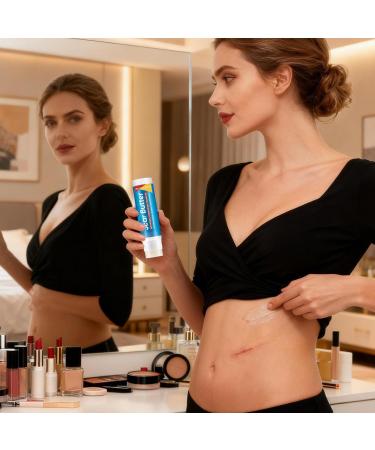 Scars Cream - 20g Light Butter Non Sticky Body Cream Butter Stick For Scars Burn | For Hands Legs Knees Neck Burn Buttons Women Face Body - Buy Online on GoSupps.com