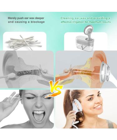 Rechargeable Ear Cleaner - 4 Modes Ear Wax Removal Kit for Adults | Automatic Earwax Removal Solution - Buy Online on GoSupps.com