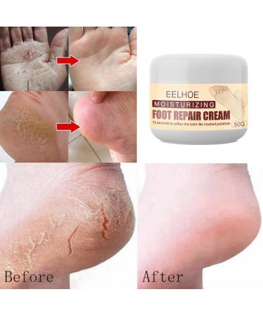 Vegan Foot Cream for Dry Rough & Cracked Feet | Best Callus Care - International Shipping - Buy Online on GoSupps.com