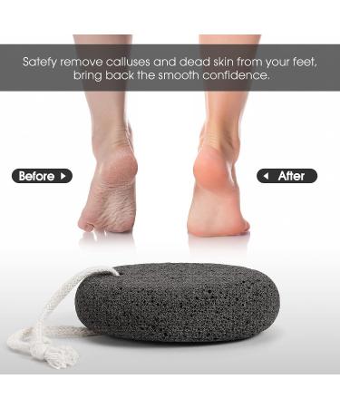 Pumice Stone for Feet - Natural Exfoliator and Callus Remover for Smooth Skin on Feet, Hands, Heels, and Elbows - Buy Online on GoSupps.com