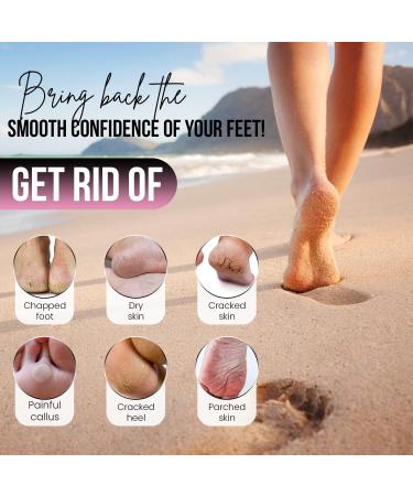 Glamza Foot Pumice Sponge Callus Exfoliate Stone Hard Skin Remove Pedicure Scrubber Pack of 4 - Buy Online on GoSupps.com