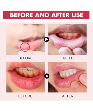Koahde Gums Relief Gel - 30g | Repair Gums Promote Gum Growth & Regrowth | Ultimate Oral Care Solution - Buy Online on GoSupps.com
