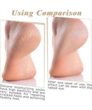 Cracked Heel Repair Socks - 2 Pairs Moisturizing Spa Socks for Dry Cracked Feet - Overnight Foot Care Lotion Socks for Women (US Size 7-9 - Buy Online on GoSupps.com