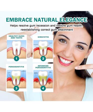  GNAUMORE Gum Growth Drops Gum Regeneration Drops Dental Care Protection For Everyone 30ml - Buy Online on GoSupps.com