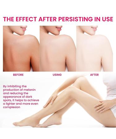 Purer Feminine Intimate Whitening Essence & Dark Knees Serum - (2pcs) - Buy Online on GoSupps.com