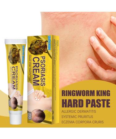 Inalsion Revitaskin Eczema Cure Cream - Eczema & Psoriasis Treatment Relief for Adults (3pcs) - Buy Online on GoSupps.com