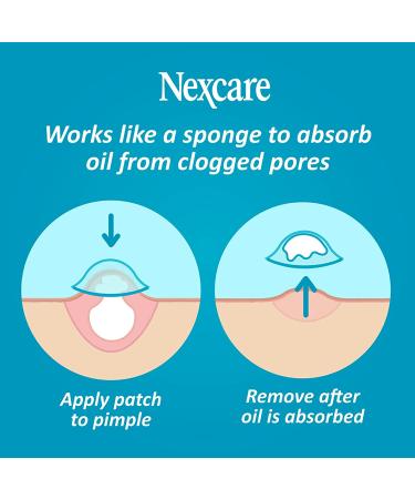 Nexcare Acne Absorbing Cover - 36 Ct Acne Patch for Blemishes - Two Sizes, Visible Results - Buy Online on GoSupps.com
