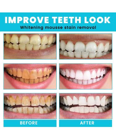 50ml Teethaid Mouthwash & Tooth Whitening Foam Natural Peppermint Oral Care (2 Pieces) for Bright White Teeth - Buy Online on GoSupps.com