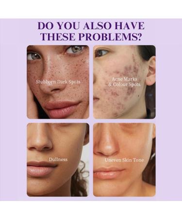 Dark Spot Corrector Serum Niacinamide Serum Brightening Serum Niacinamide+ 5% Tranexamic Acid Hydrating Serum Dark Spot Corrector For Face Age Spot Remover For Face Face Redness Remover - Buy Online on GoSupps.com
