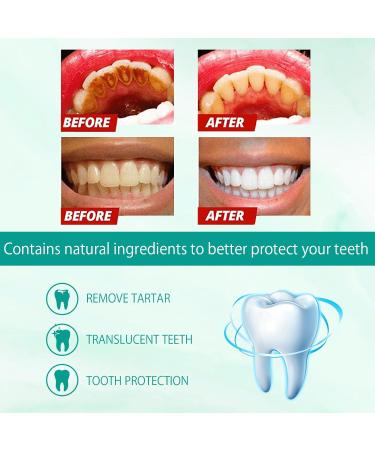 Ultra-Fine Saveuppro Teeth Whitening Mousse Toothpaste | Deep Clean & Intensive Stain Removal Foam - Buy Online on GoSupps.com