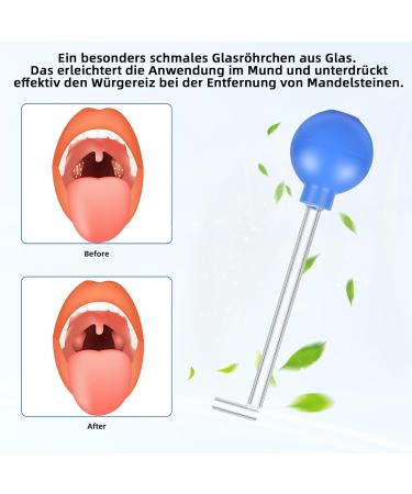 Valink Portable Tonsil Stone Remover - Stone Cleaner Tool for Adults | Right-Angled Pipe Purple & Flat Violet Design | International Shipping Available - Buy Online on GoSupps.com