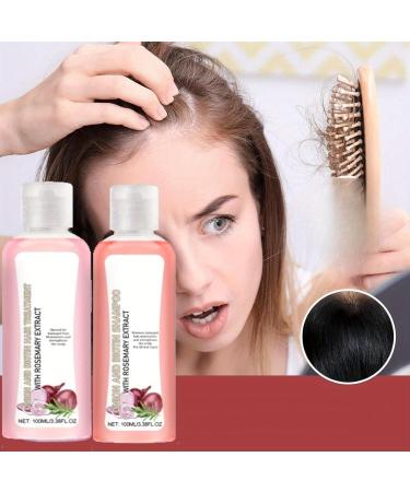 Onion Biotin & Rosemary Shampoo Set | Natural Hair Care for Dry Frizzy Hair - Hair Growth Serum with Moroccan Oil - Buy Online on GoSupps.com