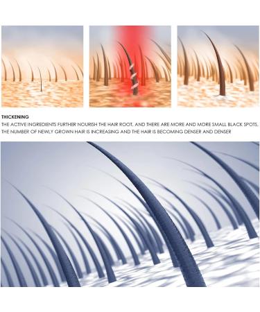 Abonda 3PCS Hair Growth Serums Hair Serums for Hair Growth Helps Stop Hair Loss Keep Hair Regrowth Hair Loss Treatments for Men and Women - Buy Online on GoSupps.com