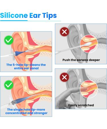Ear Wax Removal Kit | Manual Ear Irrigation System for Adults & Kids | Includes Basin, Towel, and 31 Disposable Tips - Buy Online on GoSupps.com