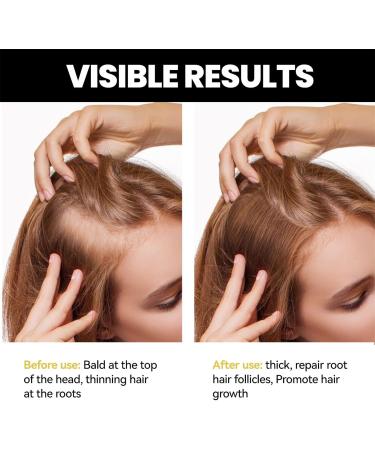 Hair Growth Oil | Dry Scalp Oil | Natural Nourishing Cold Pressed Moisturizing Organic Rosemary Oil 1.62oz for Hair Loss Promotes Zonto - Buy Online on GoSupps.com