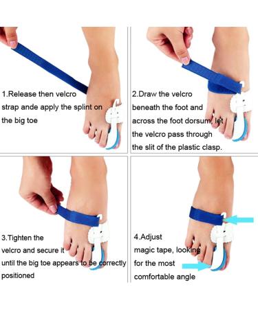 Buy SING F LTD 2 PCS Bunion Corrector & Protector | Hallux Valgus Toe Pain Relief - Buy Online on GoSupps.com