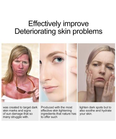 Dark Spot Corrector Serum with Alpha Arbutin, Kojic Acid & Licorice Root Extract - 30ml - Buy Online on GoSupps.com