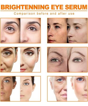 Turmeric Oil Facial Serum - Diminish Spots Illuminate Moisturize. Improves Skin Tone. For all Skin Types (10ML) - Buy Online on GoSupps.com