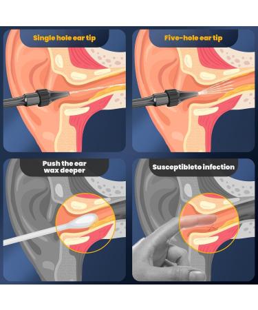 Ear Wax Removal - Electric Ear Cleaner - Ear Irrigation Kit Safe Ear Irrigation Flushing System with 4 Pressure Settings - Effective Ear Wax Removal Tool for Earwax Buildup (Dark Blue) - Buy Online on GoSupps.com