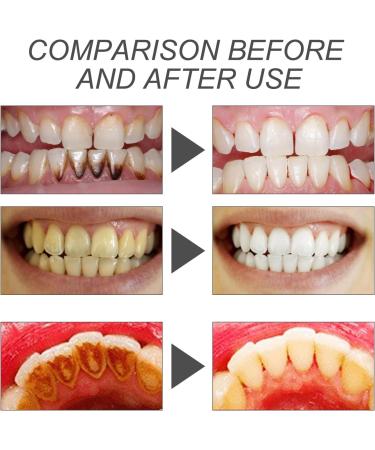 Natural Activated Carbon Tooth Whitening Powder - 2-Pack for Stain Removal & Fresh Breath - Buy Online on GoSupps.com