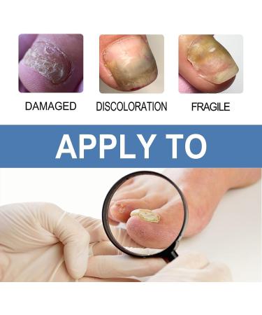  REPWEY 2023 New Healio Nail Treatment Gel Nail Strengthener Nail Growth Treatment for Brittle Peeling Breaking Thin Nails (2 Pieces) - Buy Online on GoSupps.com