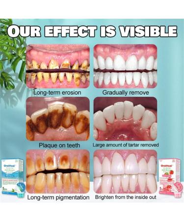 Oralheal Jelly Cup Mouthwash - Restore Oral Health & Combat Bad Breath | 3 Boxes | Fivfivgo - Buy Online on GoSupps.com