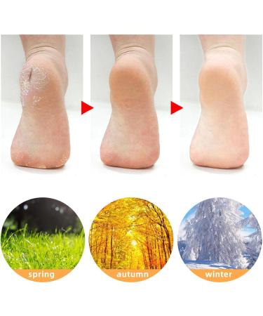 3 Pairs Silicone Moisturizing Socks Flexible Elastic Hydrating Spa Socks Pedicure Socks for Dry Cracked Feet Pink Skin Tone White (-1411240283012) - Buy Online on GoSupps.com